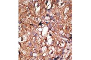 Image no. 2 for anti-5'-Nucleotidase, Ecto (CD73) (NT5E) (C-Term) antibody (ABIN357390) (CD73 anticorps  (C-Term))