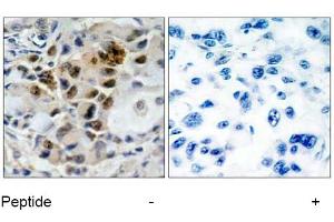 Image no. 1 for anti-Forkhead Box O4 (FOXO4) (Ser197) antibody (ABIN197368)