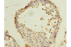 Immunohistochemistry of paraffin-embedded human testis tissue using ABIN7143124 at dilution of 1:100 (ARPM1 anticorps  (AA 1-372))