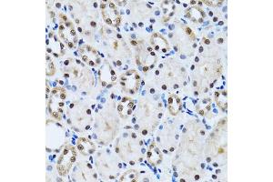 Immunohistochemistry of paraffin-embedded rat kidney using CCAR2 antibody (ABIN2563550) at dilution of 1:100 (40x lens). (CCAR2 anticorps)
