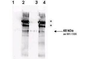 Affinity purified phospho-specific antibody to yeast Rad9 at pS1260 was used at a 1:200 dilution incubated overnight at 4° C to detect Rad9 by Western blot.