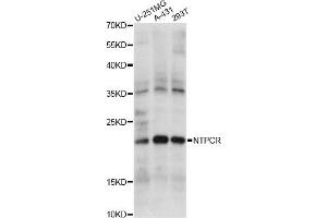 Western blot analysis of extracts of various cell lines, using NTPCR antibody. (C1orf57 anticorps)