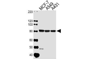 Lane 1: MCF-7 Cell lysates, Lane 2: A549 Cell lysates, Lane 3: A431 Cell lysates, probed with CAPN1 (1376CT809. (CAPNL1 anticorps)