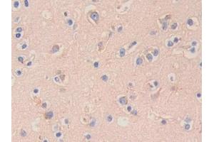 Detection of HEXb in Human Cerebrum Tissue using Polyclonal Antibody to Hexosaminidase B Beta (HEXb) (HEXB anticorps  (AA 122-311))