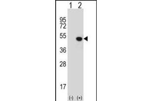 Western blot analysis of JMJD5 (arrow) using rabbit polyclonal JMJD5 Antibody (N-term) (ABIN654939 and ABIN2844581).