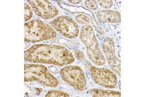 Immunohistochemistry of paraffin-embedded rat kidney using RPL4 Rabbit pAb (ABIN6129106, ABIN6147145, ABIN6147146 and ABIN6221591) at dilution of 1:100 (40x lens). (RPL4 anticorps  (AA 1-240))