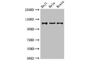 Western Blot Positive WB detected in: Raji whole cell lysate, Hela whole cell lysate, Mouse brain tissue All lanes: KIF11 antibody at 3.
