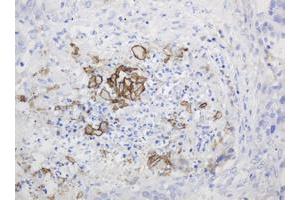 Image no. 1 for anti-Parathyroid Hormone (PTH) (AA 32-115) antibody (ABIN1491410)