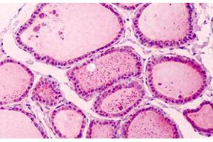 Human Thyroid: Formalin-Fixed, Paraffin-Embedded (FFPE) (PAK2 anticorps  (C-Term))