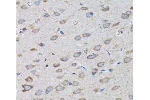 Immunohistochemistry of paraffin-embedded Rat brain using PSMD10 Polyclonal Antibody at dilution of 1:100 (40x lens). (PSMD10 anticorps)
