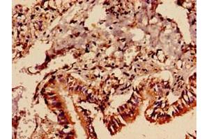 Immunocytochemistry analysis of human lung tissue using ABIN7163177 at dilution of 1:100