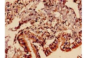 Immunocytochemistry analysis of human lung tissue using ABIN7163177 at dilution of 1:100 (PREX1 anticorps  (AA 1-44))