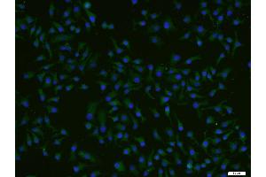 HepG2 cells were stained with ADCK4 Polyclonal Antibody, Unconjugated (bs-8070R) at 1:200 and incubated for 90 minutesat room temperature, followed by secondary antibody incubation, DAPI staining of the nuclei and detection. (ADCK4 anticorps  (AA 65-170))