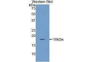 Detection of Recombinant KRT19, Human using Polyclonal Antibody to Cytokeratin 19 (CK19) (Cytokeratin 19 anticorps  (AA 245-391))