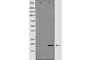 Western blot analysis of extracts of mouse liver, using CAMP antibody. (Cathelicidin anticorps  (Internal Region))