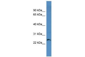 WB Suggested Anti-Cacng1 Antibody Titration:  0. (CACNG1 anticorps  (Middle Region))
