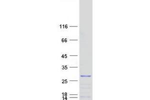 Validation with Western Blot