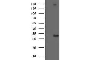 Western Blotting (WB) image for anti-Regulatory Factor X-Associated Ankyrin Containing Protein (RFXANK) antibody (ABIN1500682) (RFXANK anticorps)