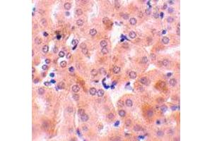 Immunohistochemistry of BCL2A1 in mouse kidney tissue with BCL2A1 polyclonal antibody  at 10 ug/mL .