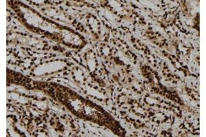 ABIN6279801 at 1/100 staining Human kidney tissue by IHC-P. (ULK2 anticorps  (Internal Region))