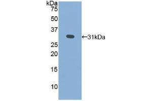 Western blot analysis of recombinant Human GLa. (GLA anticorps  (AA 147-371))