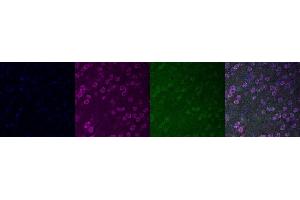 Immunohistochemistry (IHC) image for anti-Transient Receptor Potential Cation Channel, Subfamily C, Member 6 (TRPC6) antibody (ABIN7456173)