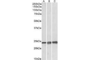 ABIN308466 (0. (Peroxiredoxin 1 anticorps  (Internal Region))