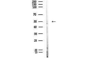 anti-Aminolevulinate, delta-, Synthase 1 (ALAS1) (Internal Region) antibody