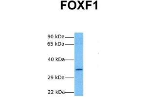 Host:  Rabbit  Target Name:  FOXF1  Sample Tissue:  Human Hela  Antibody Dilution:  1.