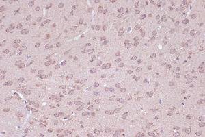 Immunohistochemistry of paraffin-embedded mouse brain using B Rabbit mAb (ABIN7265849) at dilution of 1:100 (40x lens).
