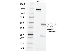anti-TAG-72 / CA72.4 antibody
