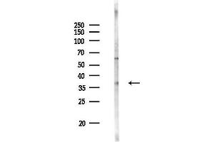 anti-Peroxisomal Biogenesis Factor 16 (PEX16) (Internal Region) antibody