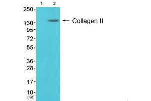 Western Blotting (WB) image for anti-Collagen, Type II (COL2) (N-Term) antibody (ABIN1848474)