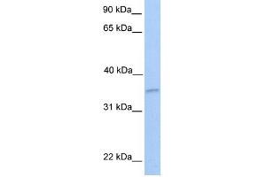 WB Suggested Anti-NKIRAS2 Antibody Titration: 0. (NKIRAS2 anticorps  (Middle Region))