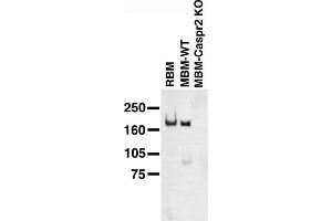 Immunoblot on adult rat brain membrane (RBM), and adult mouse brain membranes (MBM) from wild-type (WT) and Caspr2 knockout mice. (CNTNAP2 anticorps  (Extracellular))