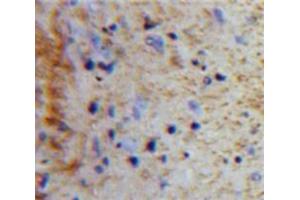 Used in DAB staining on fromalin fixed paraffin-embedded Brain tissue (Peptide YY anticorps  (AA 31-97))