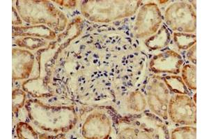 anti-SP110 Nuclear Body Protein (SP110) (AA 137-386) antibody