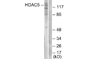 Western blot analysis of extracts from HepG2 cells, treated with PMA (125ng/ml, 30mins), using HDAC5 antibody (#C0225). (HDAC5 anticorps)