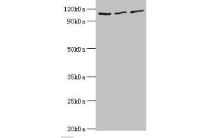 Western blot All lanes: MERTK antibody at 8 μg/mL Lane 1: Mouse gonad tissue Lane 2: Mouse lung tissue Lane 3: Mouse kidney tissue Secondary Goat polyclonal to rabbit IgG at 1/10000 dilution Predicted band size: 110 kDa Observed band size: 110 kDa (MERTK anticorps  (AA 840-999))