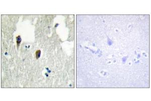 Immunohistochemistry analysis of paraffin-embedded human brain tissue, using KLHL3 antibody. (KLHL3 anticorps  (N-Term))