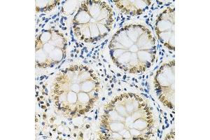 Immunohistochemistry of paraffin-embedded human colon using SNRPE Antibody (ABIN1876676) at dilution of 1:200 (40x lens). (SNRPE anticorps)