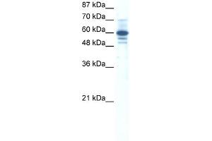 WB Suggested Anti-ZNF276 Antibody Titration:  0. (ZNF276 anticorps  (Middle Region))