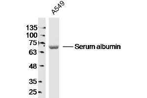 A549 lysates probed with Serum albumin Polyclonal Antibody, Unconjugated  at 1:300 dilution and 4˚C overnight incubation. (Albumin anticorps)