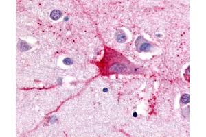 Anti-TRH Receptor antibody IHC of human brain, neurons and glia. (TRHR anticorps  (Cytoplasmic Domain))