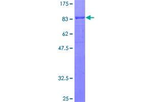 Osteoactivin (GPNMB) (AA 1-572) protein (GST tag)