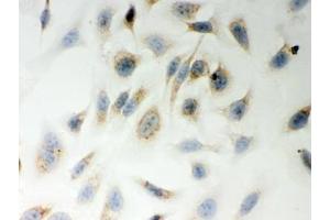 ICC testing of FFPE human HeLa cells with LYRIC antibody. (MTDH anticorps  (AA 101-270))