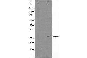 Western blot analysis on MCF7 cell lysate using BCL-2 Antibody，The lane on the left is treated with the antigen-specific peptide. (Bcl-2 anticorps  (Internal Region))