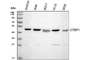 Western blot analysis of CTBP1 using anti-CTBP1 antibody (ABIN3043816). (CTBP1 anticorps  (C-Term))