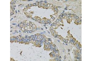 Immunohistochemistry of paraffin-embedded Human prostate using ALDH3A1 Polyclonal Antibody at dilution of 1:100 (40x lens).