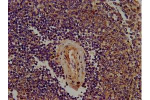 IHC image of ABIN7169553 diluted at 1:400 and staining in paraffin-embedded human spleen tissue performed on a Leica BondTM system.